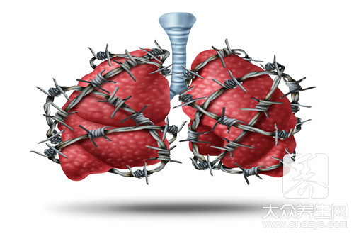 膈肌炎症状