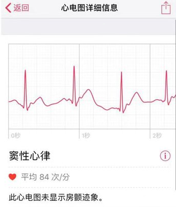 Apple Watch怎么查看心电图?Apple Watch查看心电图技巧