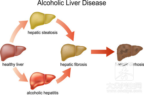 喝酒肝损伤的症状