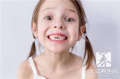 孩子换门牙多久长出来？