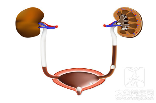 尿结石怎么引起的