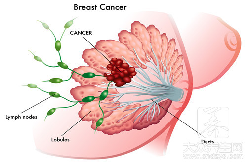 乳腺肿瘤切除手术