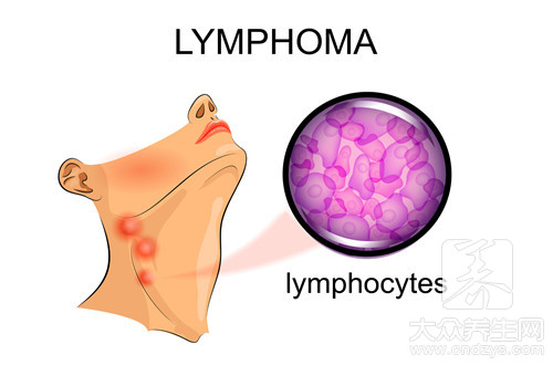 淋巴瘤中药治疗方法