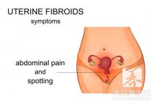 慢性宫颈炎的症状