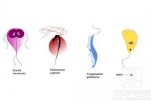 男性滴虫病的治疗