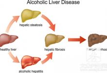 喝酒肝损伤的症状
