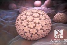 怎么判断自己感染HPV？医生坦言：这样八九不离十，调理要快