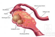 卵巢疼痛怎么回事