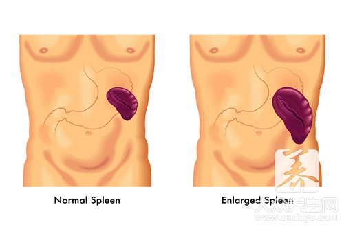 脾大切除有什么危害
