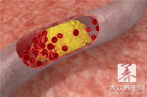 扁平疣和汗管瘤区别