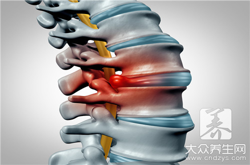 腰椎间盘突出做微创