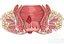 肛门上长了个血泡