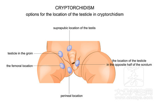 右侧睾丸隐痛吃什么药呢
