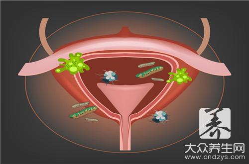 膀胱炎尿道炎吃什么药